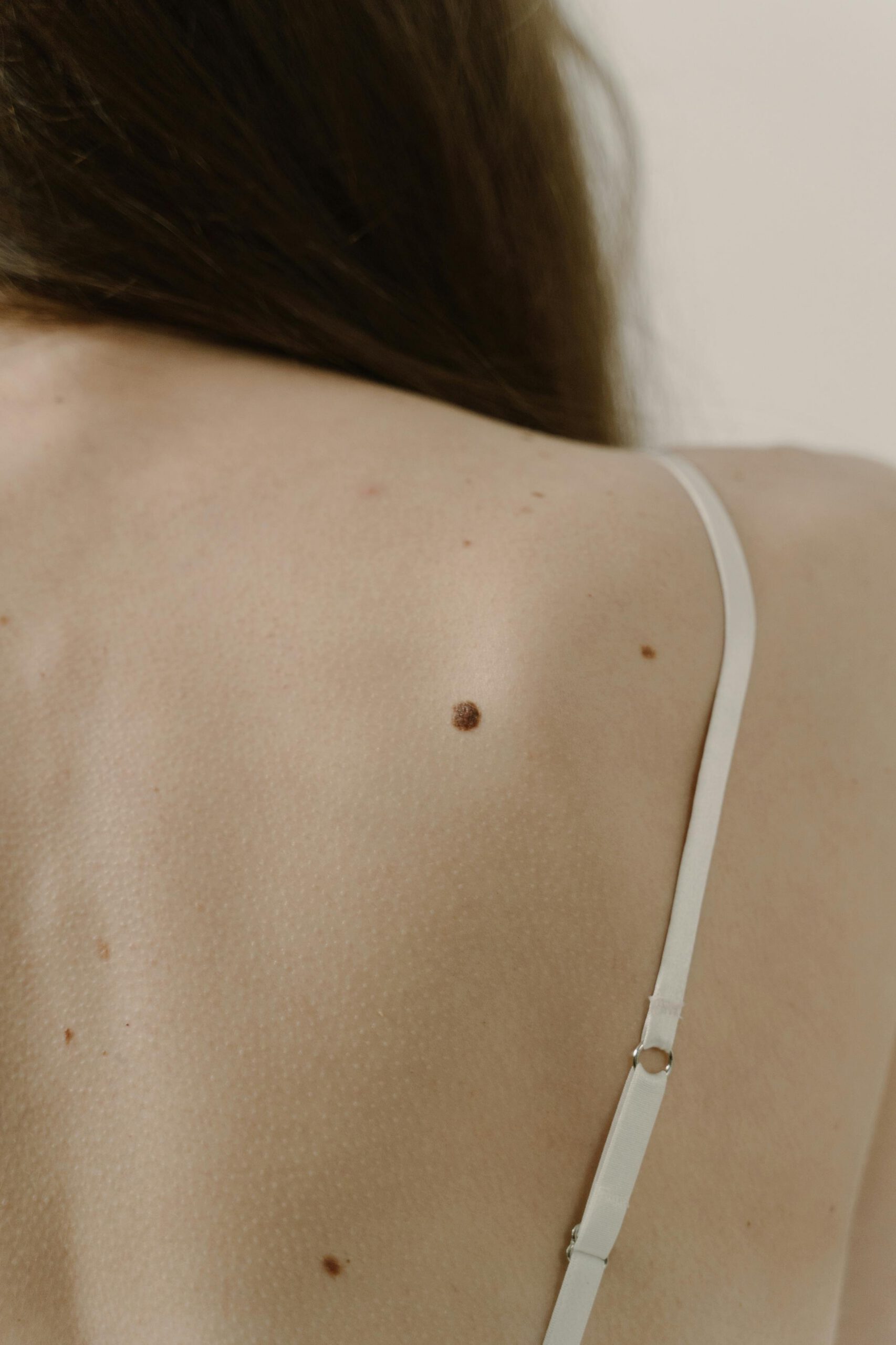How to Do a Self-Skin Check at Home (and What to Look For)
