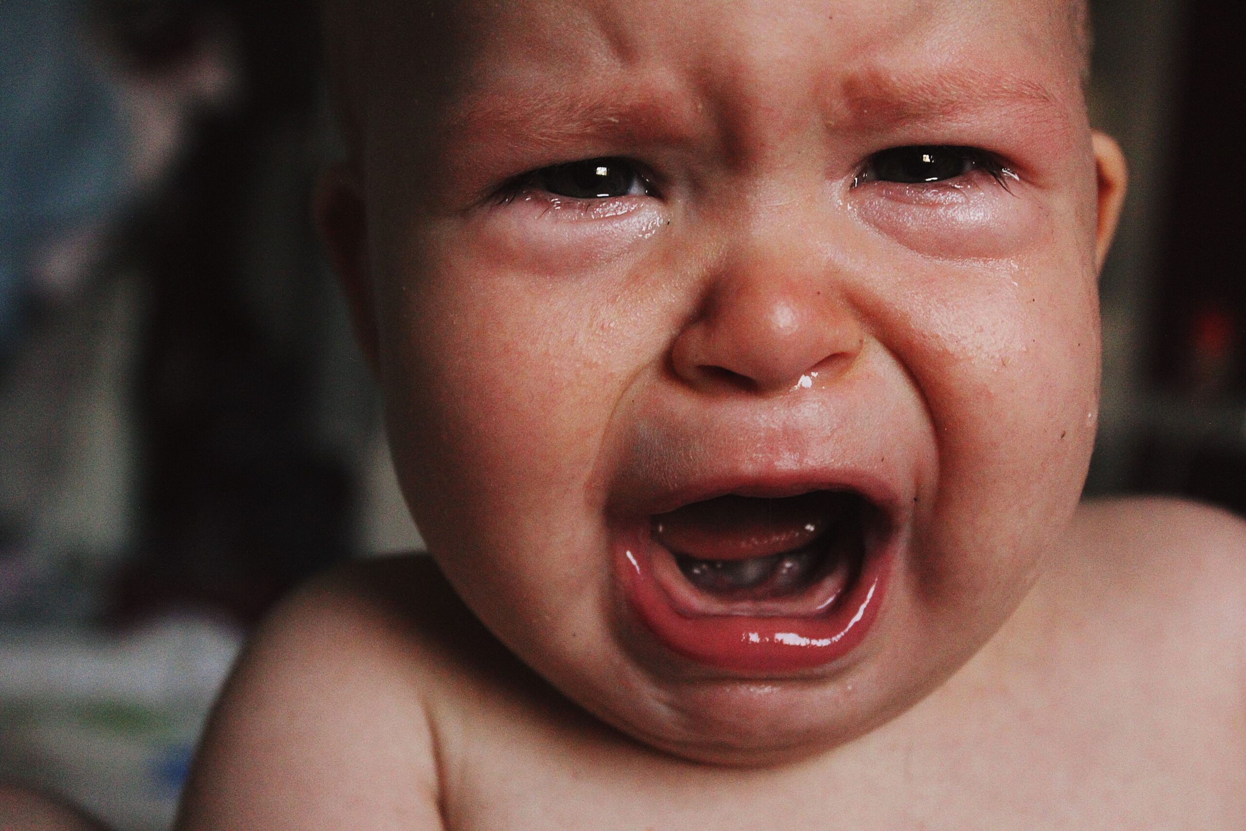 Eczema in Babies and Toddlers: What Parents Need to Know