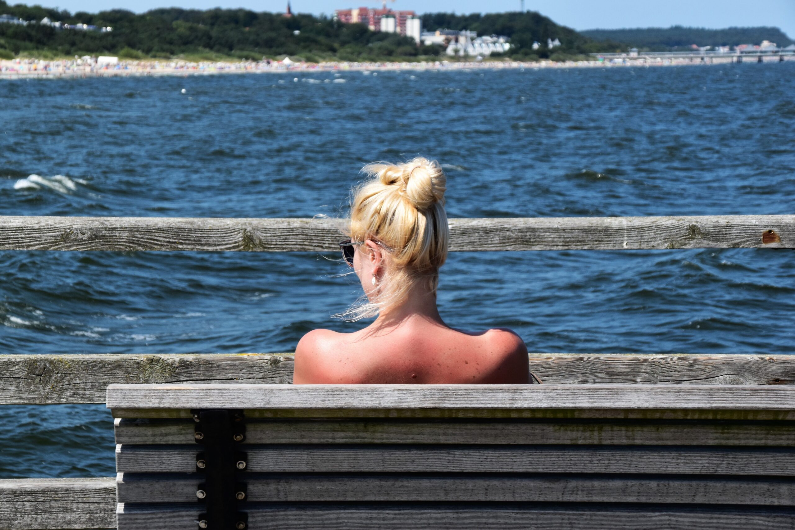 A close-up of a person applying sunscreen to a sun-exposed shoulder near the water, promoting skin cancer prevention.