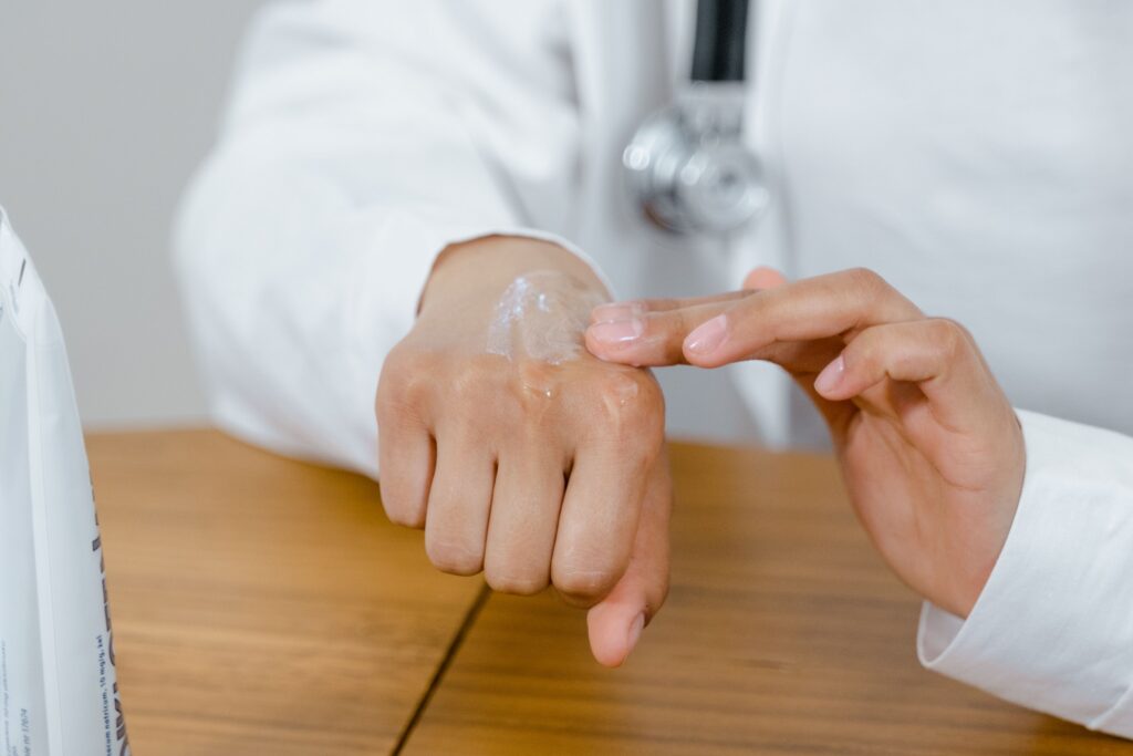 Dermatologist applying prescription topical treatment for psoriasis eczema summer flare