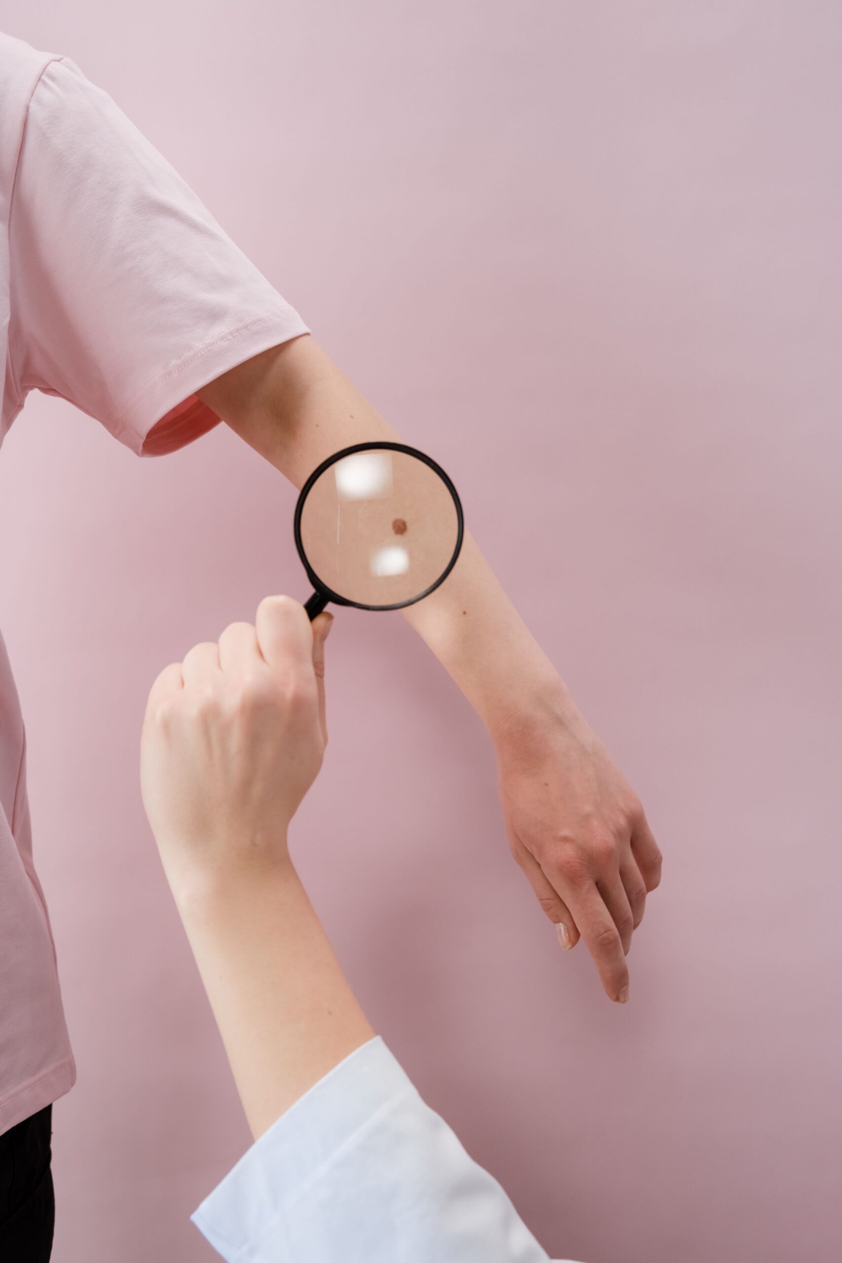 Dark Spots on Skin After Summer: 5 Essential Facts About Hyperpigmentation