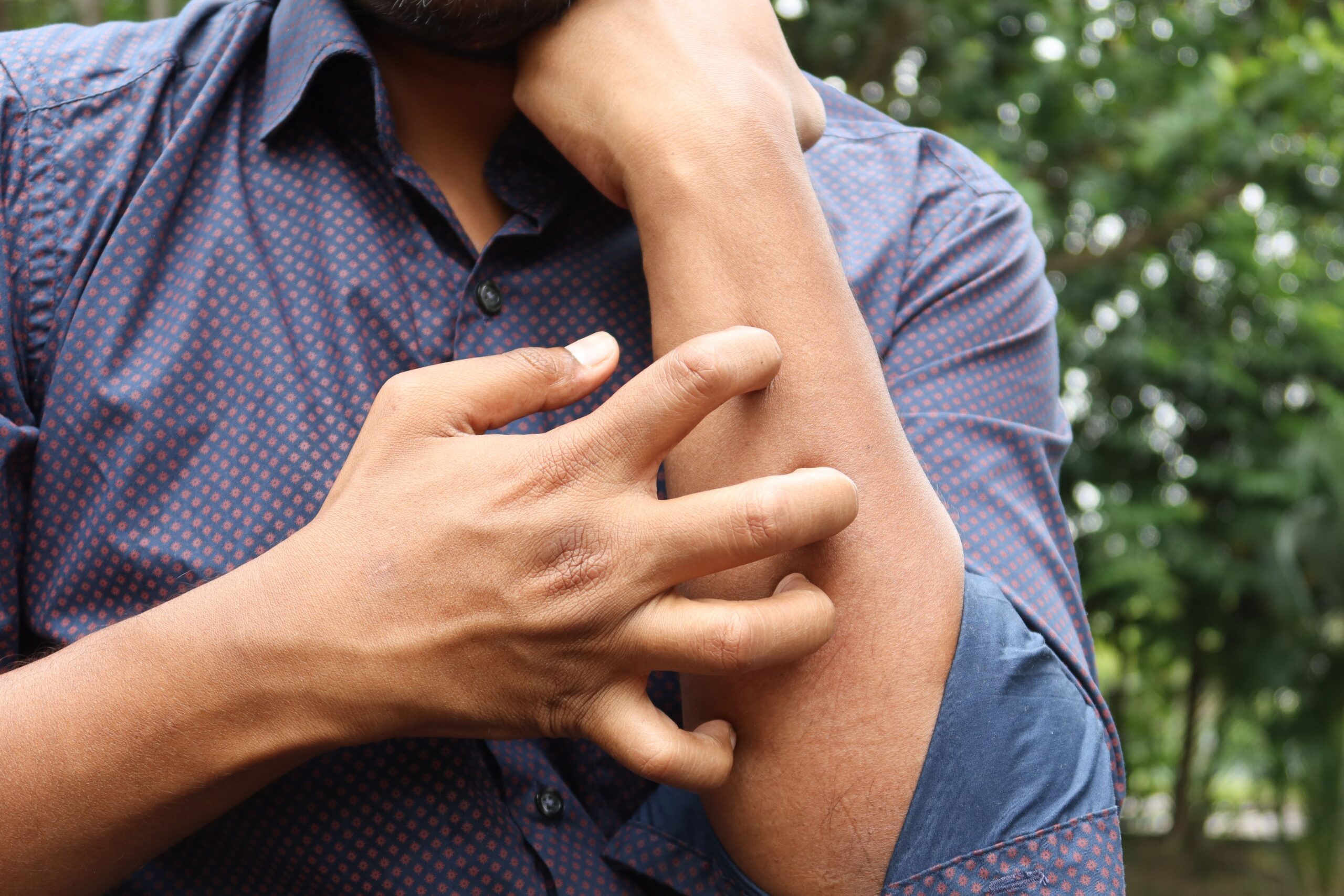 Man scratching itchy arm outdoors, a common sign of contact dermatitis treatment needed from a dermatologist