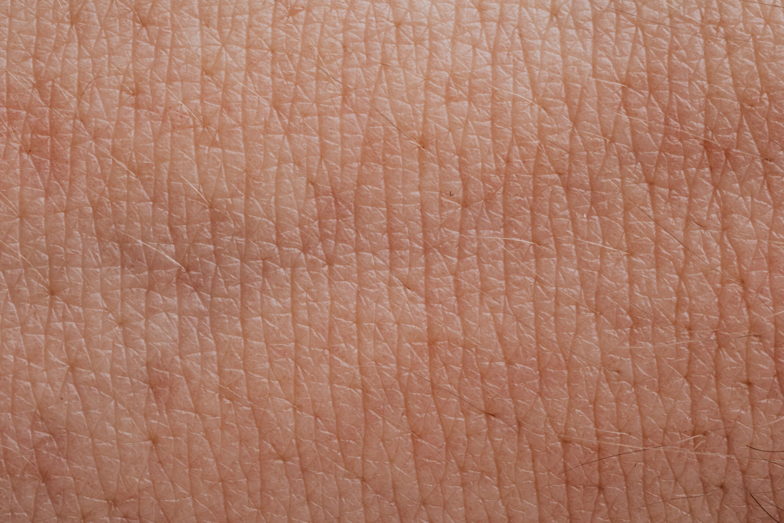 Close-up of dry flaky skin texture showing the effects of low humidity in fall