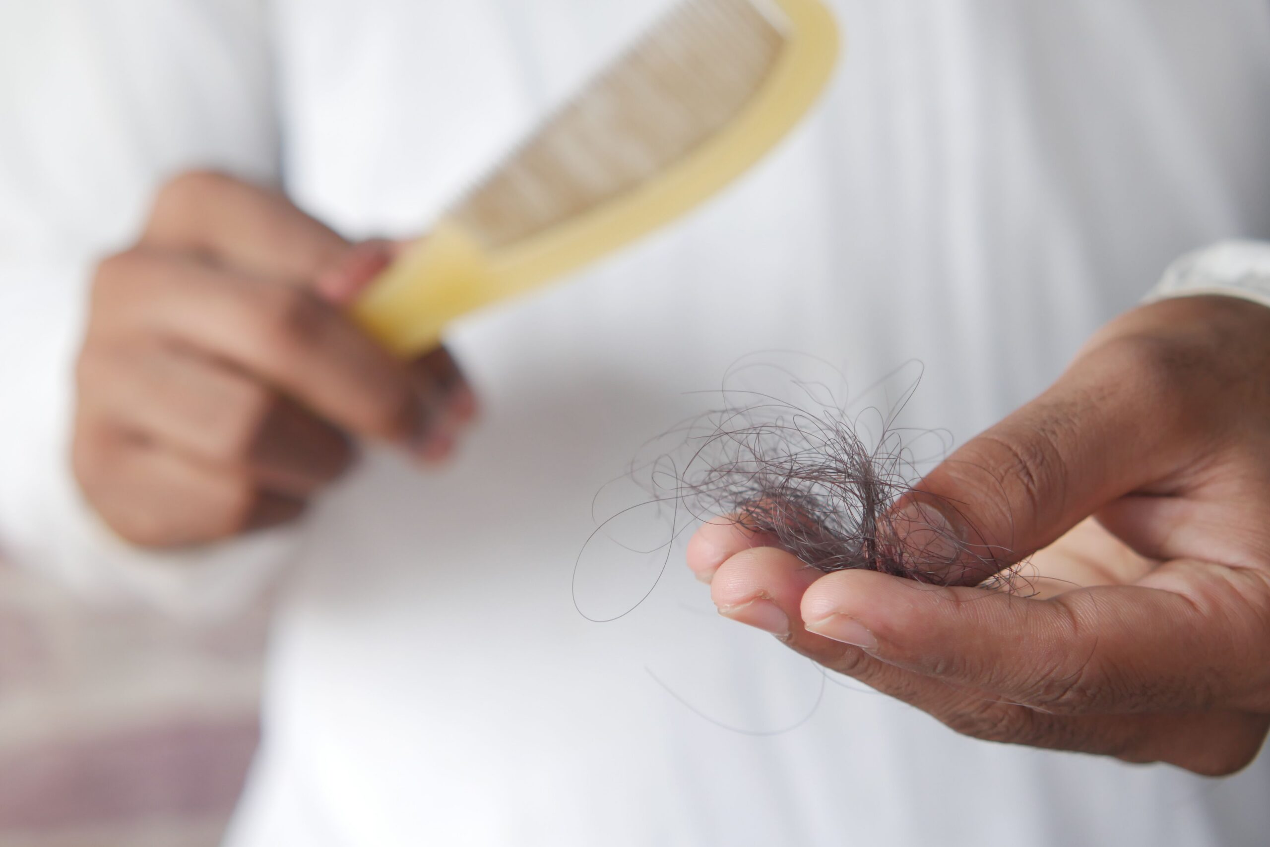 Hair Loss: 5 Hidden Causes and When to See a Dermatologist