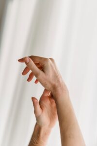 Hands showing dry irritated skin from a psoriasis flare during cold weather in Chattanooga TN